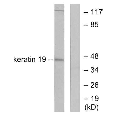Western Blot - Anti-Keratin 19 Antibody (C0244) - Antibodies.com