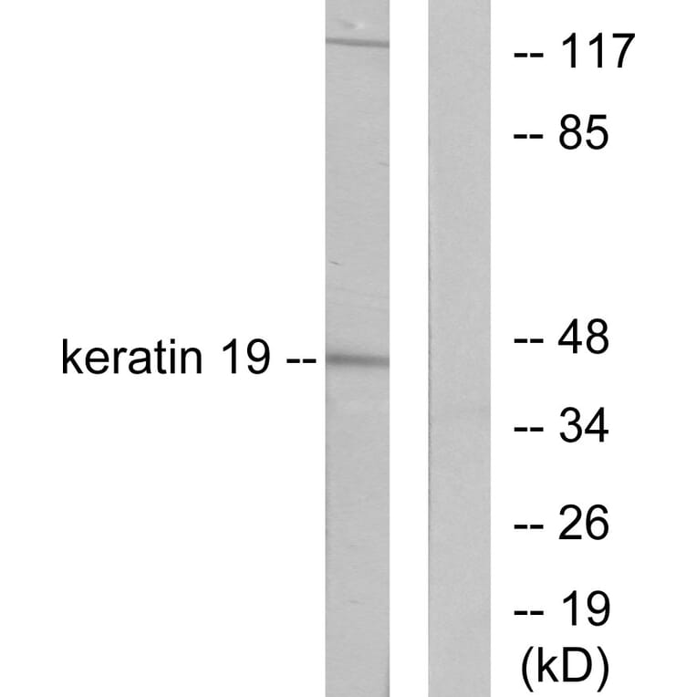 Western Blot - Anti-Keratin 19 Antibody (C0244) - Antibodies.com