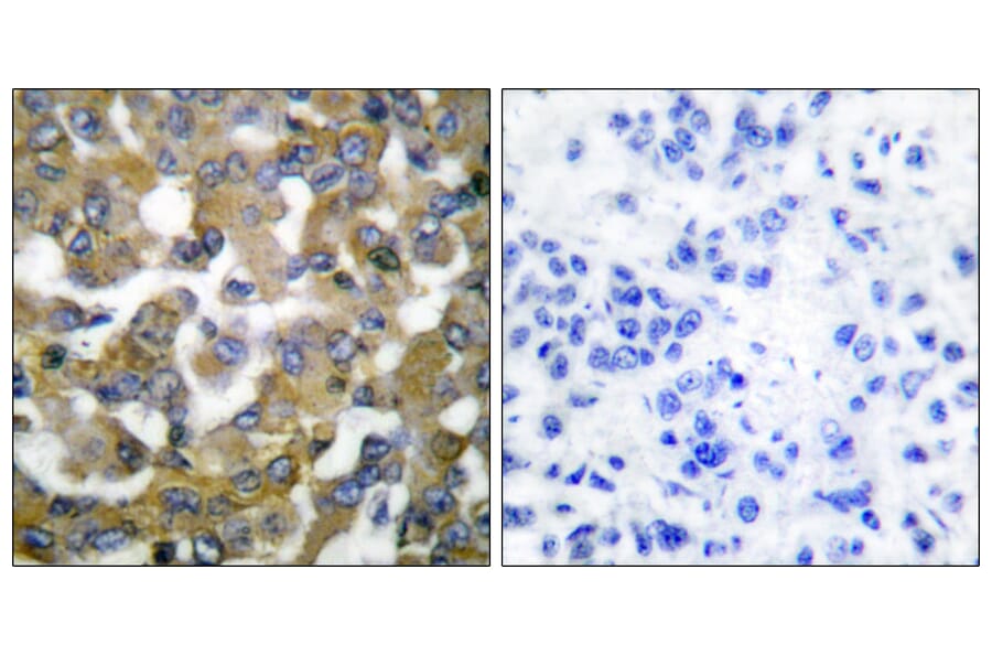 Immunohistochemistry - Anti-Keratin 19 Antibody (C0244) - Antibodies.com