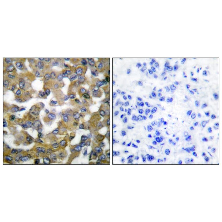 Immunohistochemistry - Anti-Keratin 19 Antibody (C0244) - Antibodies.com