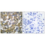 Immunohistochemistry - Anti-Keratin 19 Antibody (C0244) - Antibodies.com