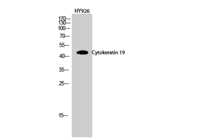Western Blot - Anti-Keratin 19 Antibody (C0244) - Antibodies.com