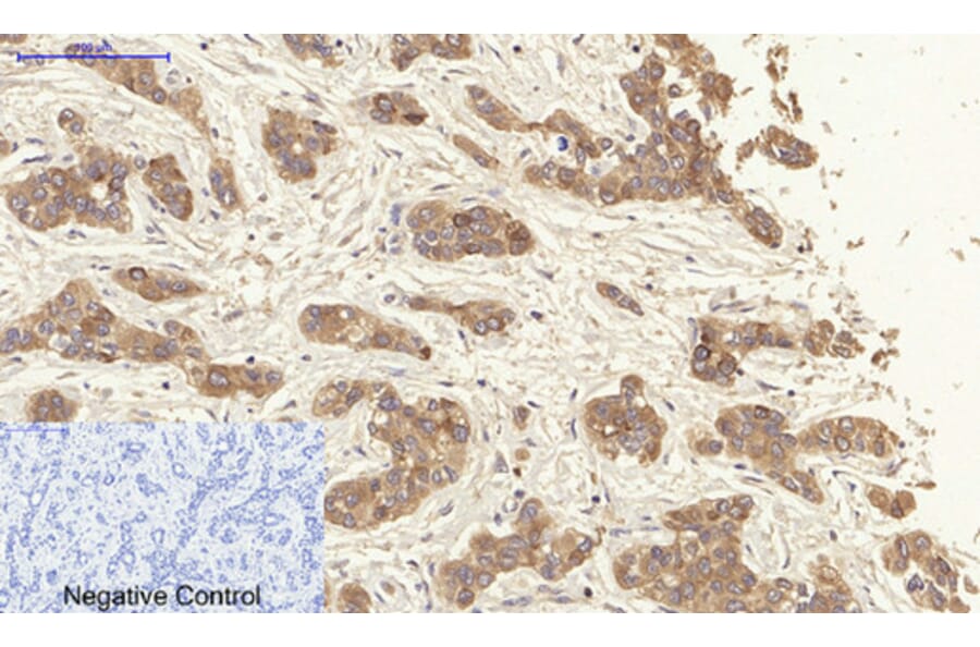 Immunohistochemistry - Anti-Keratin 19 Antibody (C0244) - Antibodies.com