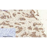 Immunohistochemistry - Anti-Keratin 19 Antibody (C0244) - Antibodies.com