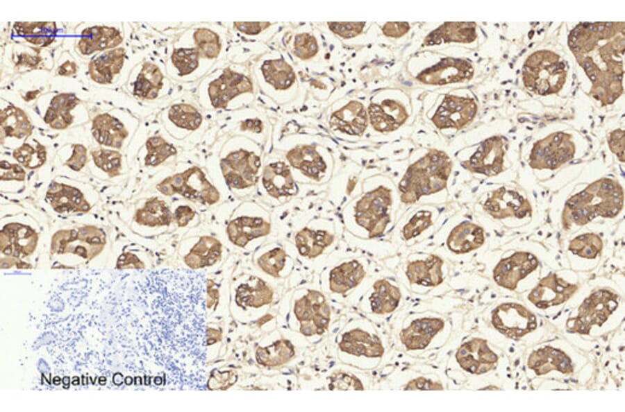 Immunohistochemistry - Anti-Keratin 19 Antibody (C0244) - Antibodies.com