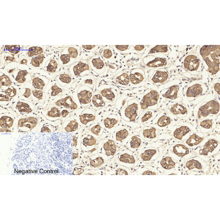 Immunohistochemistry - Anti-Keratin 19 Antibody (C0244) - Antibodies.com