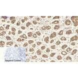 Immunohistochemistry - Anti-Keratin 19 Antibody (C0244) - Antibodies.com