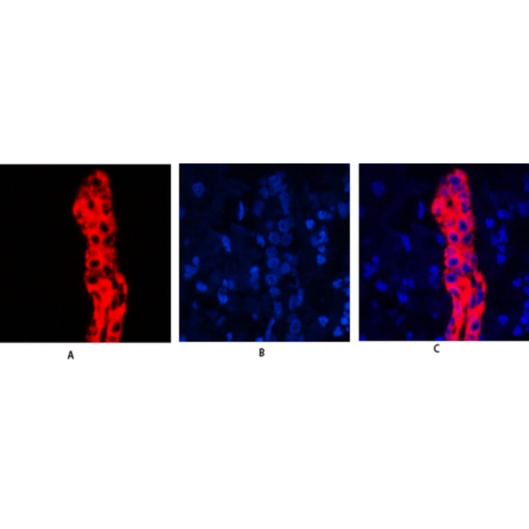 Immunofluorescence - Anti-Keratin 19 Antibody (C0244) - Antibodies.com