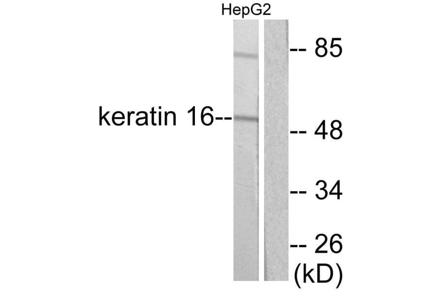 Western Blot - Anti-Keratin 16 Antibody (C0241) - Antibodies.com