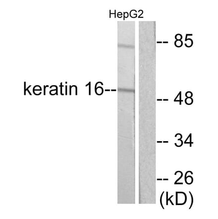 Western Blot - Anti-Keratin 16 Antibody (C0241) - Antibodies.com