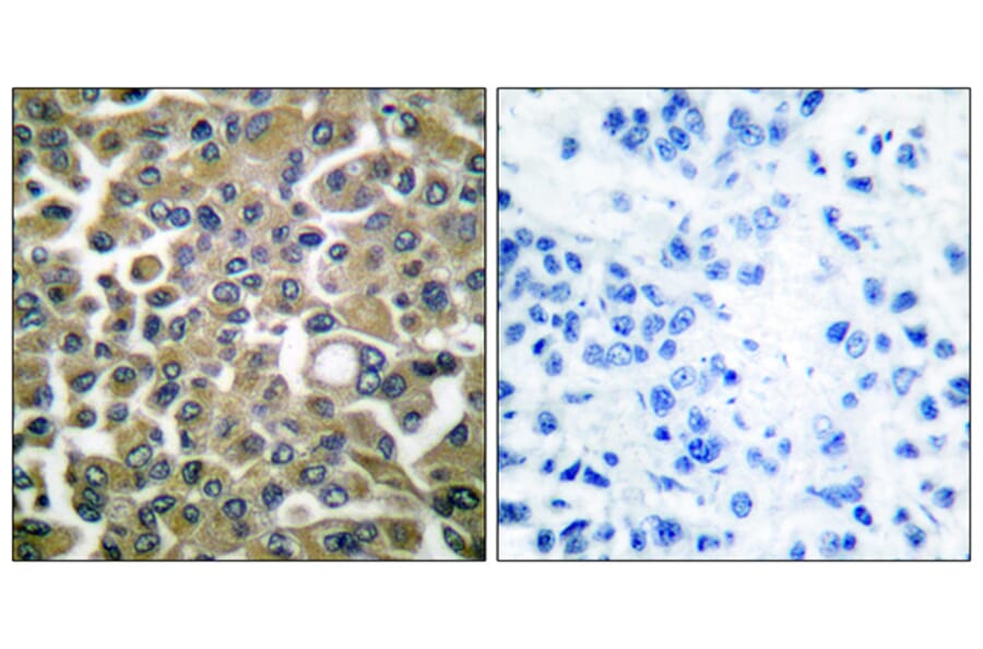 Immunohistochemistry - Anti-Keratin 16 Antibody (C0241) - Antibodies.com