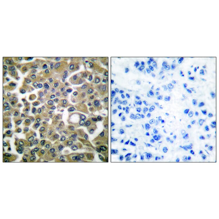 Immunohistochemistry - Anti-Keratin 16 Antibody (C0241) - Antibodies.com