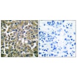 Immunohistochemistry - Anti-Keratin 16 Antibody (C0241) - Antibodies.com
