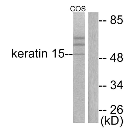 Western Blot - Anti-Keratin 15 Antibody (C0240) - Antibodies.com