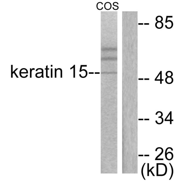Western Blot - Anti-Keratin 15 Antibody (C0240) - Antibodies.com