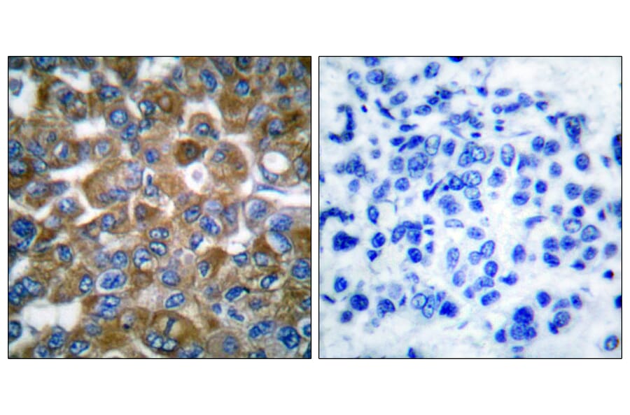 Immunohistochemistry - Anti-Keratin 15 Antibody (C0240) - Antibodies.com