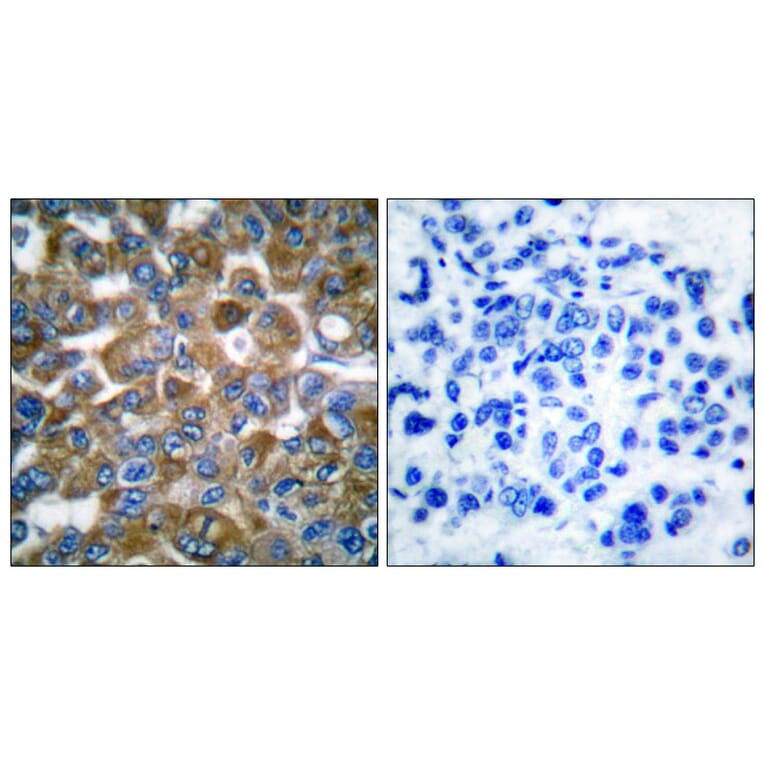 Immunohistochemistry - Anti-Keratin 15 Antibody (C0240) - Antibodies.com