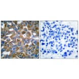 Immunohistochemistry - Anti-Keratin 15 Antibody (C0240) - Antibodies.com