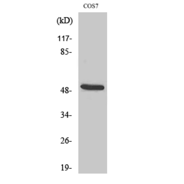 Western Blot - Anti-Keratin 15 Antibody (C0240) - Antibodies.com