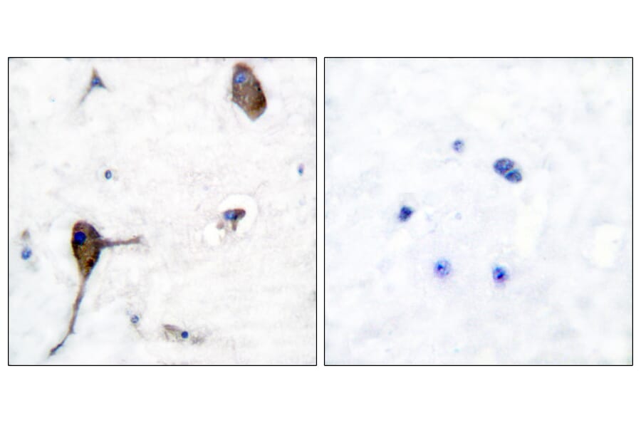 Immunohistochemistry - Anti-IL-3R beta Antibody (B0444) - Antibodies.com