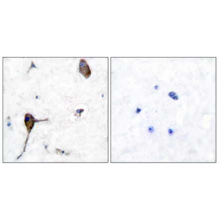 Immunohistochemistry - Anti-IL-3R beta Antibody (B0444) - Antibodies.com