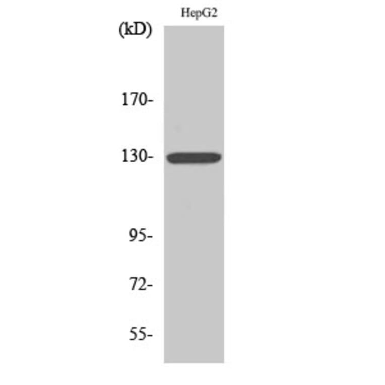 Western Blot - Anti-IL-3R beta Antibody (B0444) - Antibodies.com