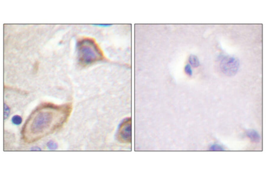 Immunohistochemistry - Anti-IL-3R beta Antibody (B0444) - Antibodies.com