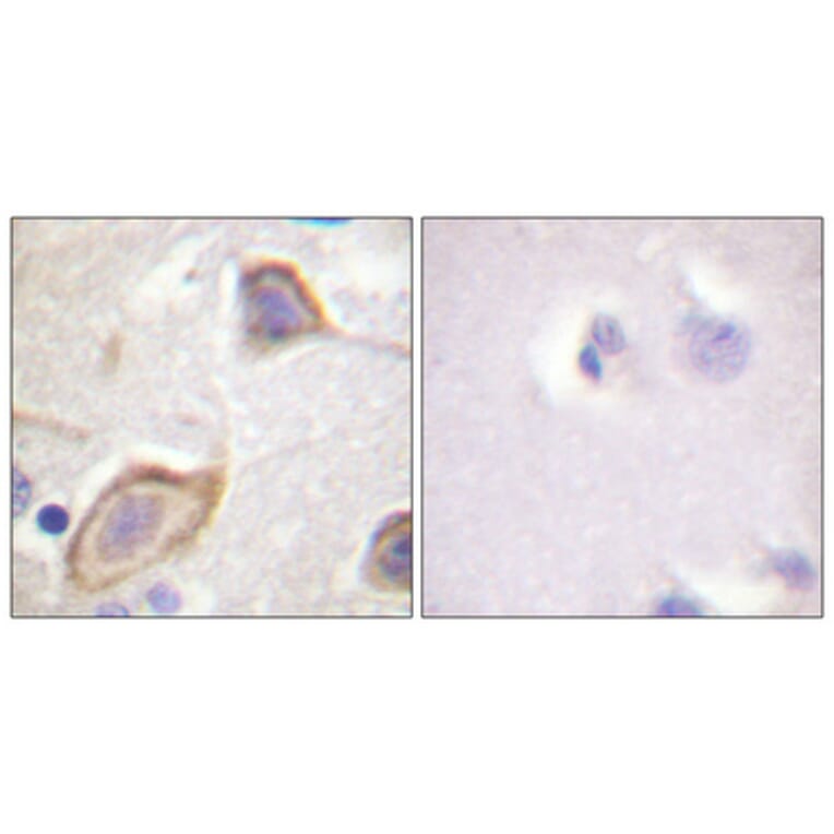 Immunohistochemistry - Anti-IL-3R beta Antibody (B0444) - Antibodies.com