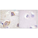 Immunohistochemistry - Anti-IL-3R beta Antibody (B0444) - Antibodies.com