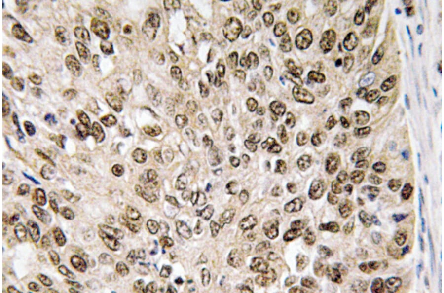 Immunohistochemistry - Anti-HIF-1alpha Antibody (R12-2180) - Antibodies.com