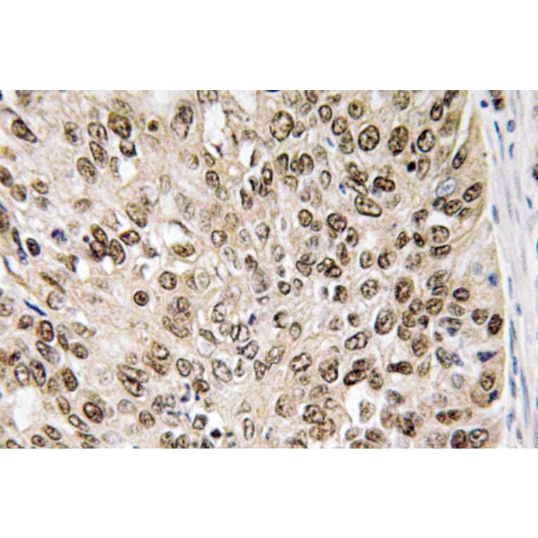 Immunohistochemistry - Anti-HIF-1alpha Antibody (R12-2180) - Antibodies.com