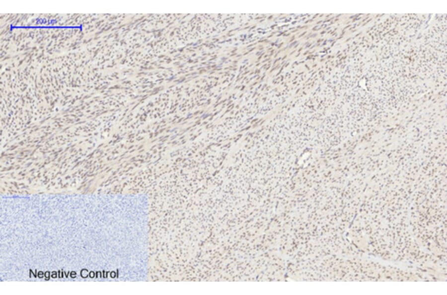 Immunohistochemistry - Anti-HIF-1alpha Antibody (R12-2180) - Antibodies.com