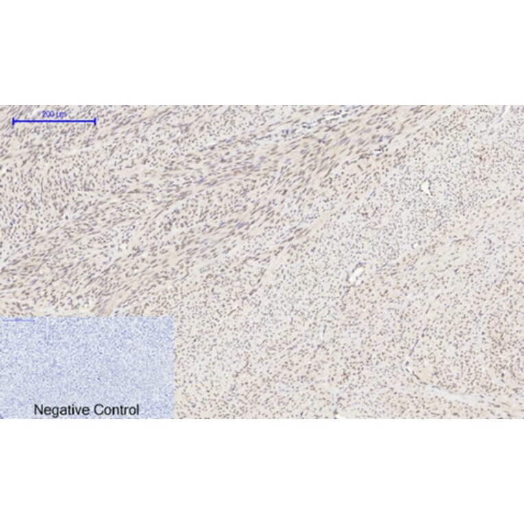 Immunohistochemistry - Anti-HIF-1alpha Antibody (R12-2180) - Antibodies.com