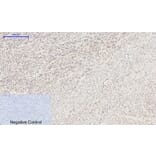 Immunohistochemistry - Anti-HIF-1alpha Antibody (R12-2180) - Antibodies.com