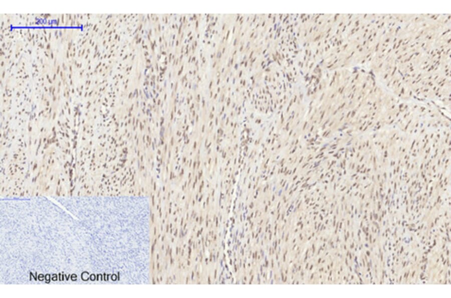 Immunohistochemistry - Anti-HIF-1alpha Antibody (R12-2180) - Antibodies.com