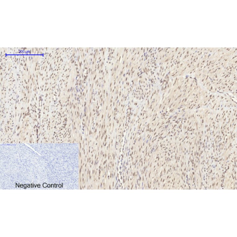 Immunohistochemistry - Anti-HIF-1alpha Antibody (R12-2180) - Antibodies.com