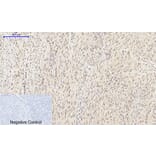 Immunohistochemistry - Anti-HIF-1alpha Antibody (R12-2180) - Antibodies.com