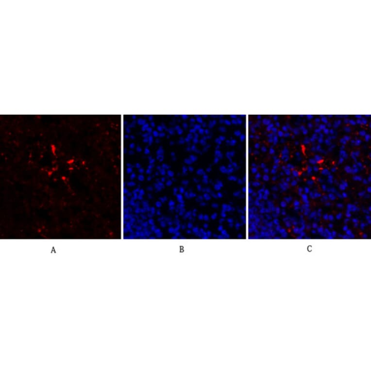 Immunofluorescence - Anti-HIF-1alpha Antibody (R12-2180) - Antibodies.com