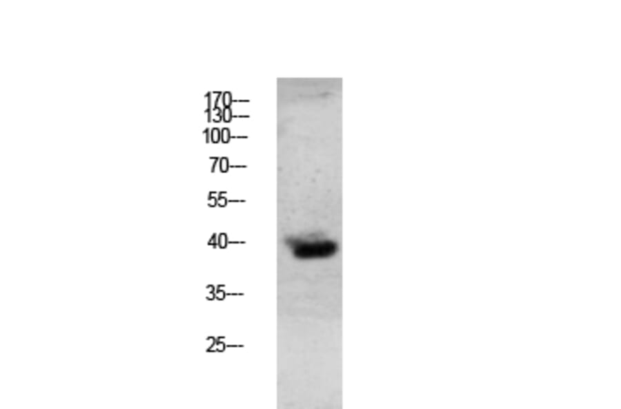 Western Blot - Anti-Granzyme B Antibody (C0215) - Antibodies.com