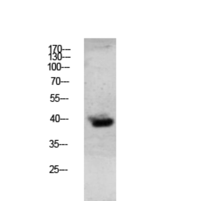 Western Blot - Anti-Granzyme B Antibody (C0215) - Antibodies.com