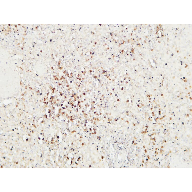 Immunohistochemistry - Anti-Granzyme B Antibody (C0215) - Antibodies.com