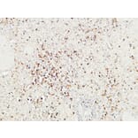Immunohistochemistry - Anti-Granzyme B Antibody (C0215) - Antibodies.com