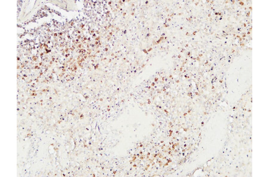 Immunohistochemistry - Anti-Granzyme B Antibody (C0215) - Antibodies.com