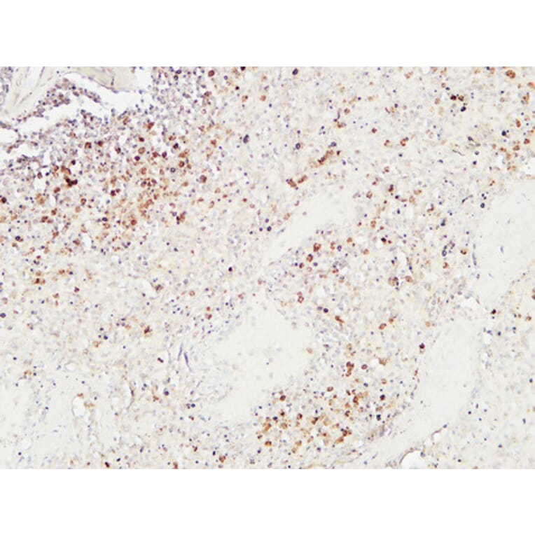 Immunohistochemistry - Anti-Granzyme B Antibody (C0215) - Antibodies.com