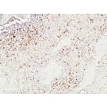 Immunohistochemistry - Anti-Granzyme B Antibody (C0215) - Antibodies.com