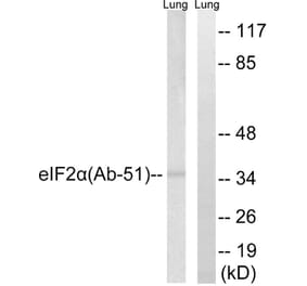 Western Blot - Anti-eIF2 alpha Antibody (B7066) - Antibodies.com
