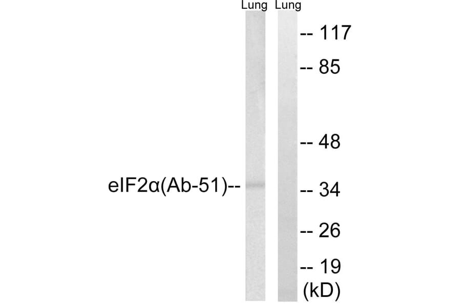 Western Blot - Anti-eIF2 alpha Antibody (B7066) - Antibodies.com