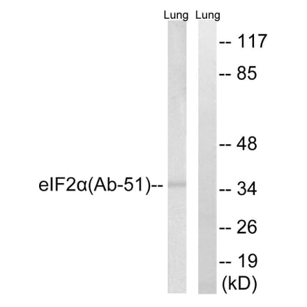 Western Blot - Anti-eIF2 alpha Antibody (B7066) - Antibodies.com
