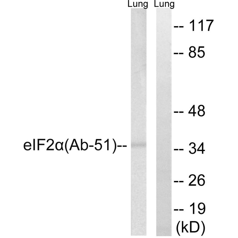 Western Blot - Anti-eIF2 alpha Antibody (B7066) - Antibodies.com