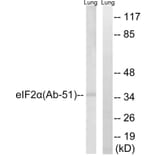 Western Blot - Anti-eIF2 alpha Antibody (B7066) - Antibodies.com